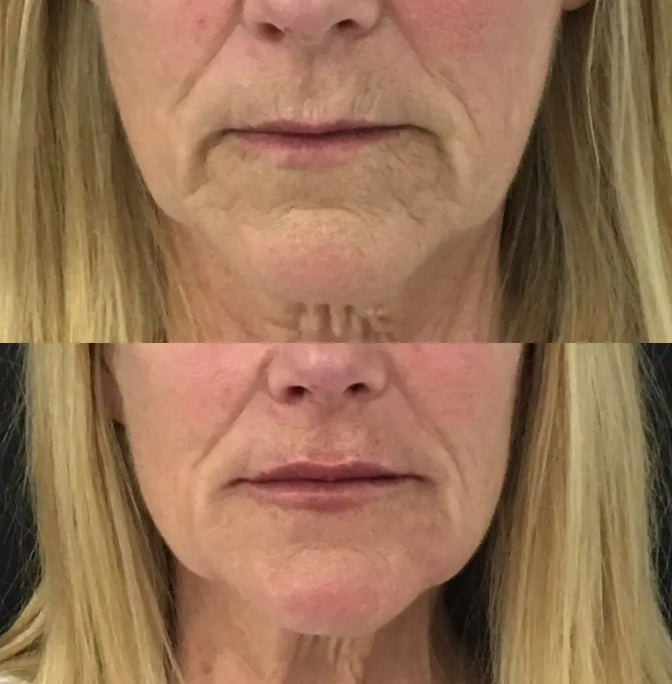 Finones - Skin Vitamin Serum