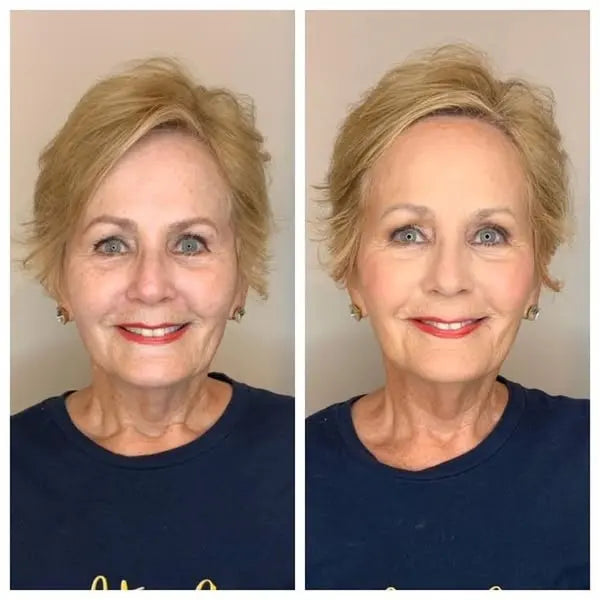 Finones - Skin Vitamin Serum