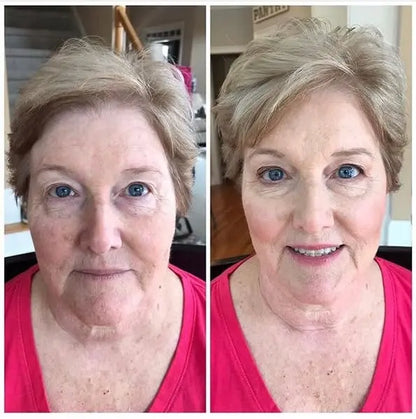 Finones - Skin Vitamin Serum