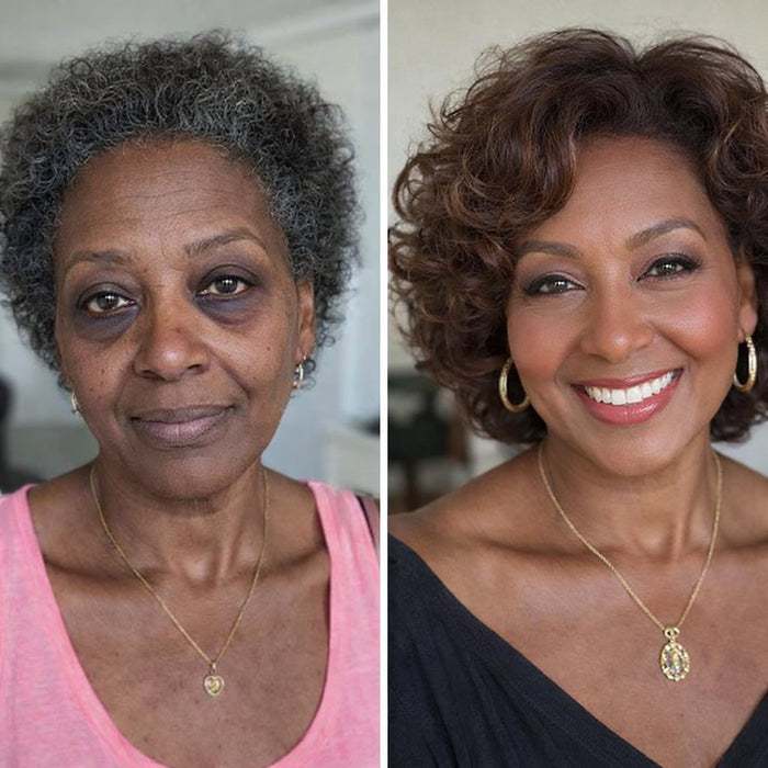 Hyperpigmentation reduction