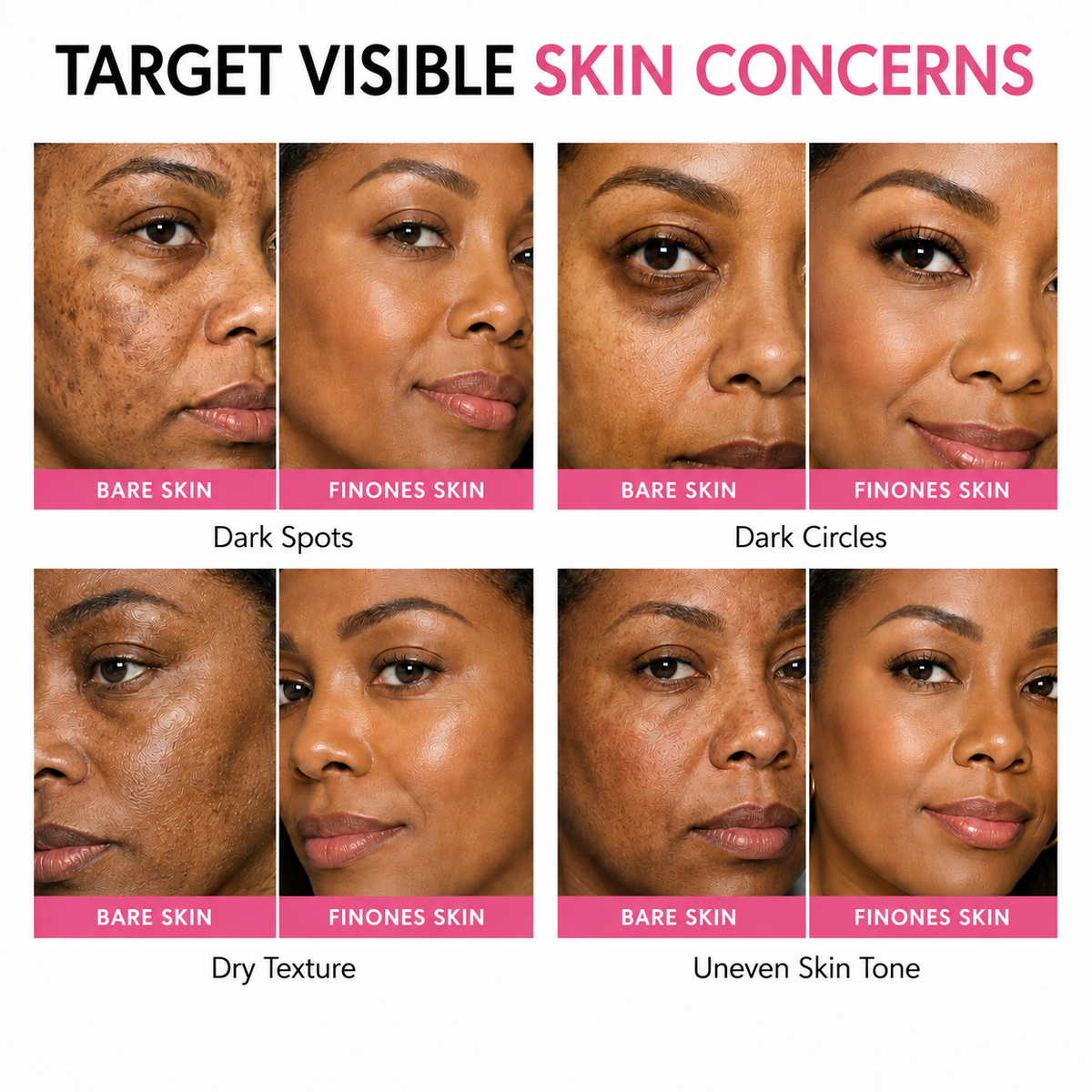Finones™ Skincare- Loaded Adaptive Foundation SPF 15++