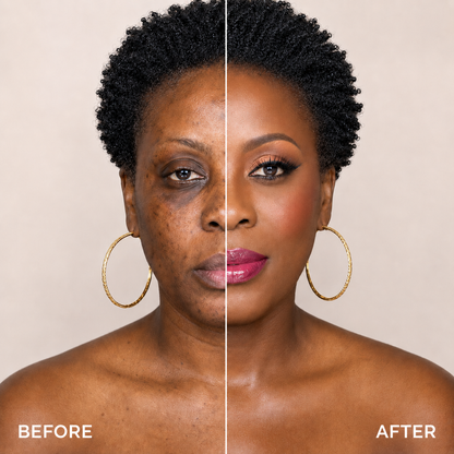 Finones™ Skincare- Loaded Adaptive Foundation SPF 15++