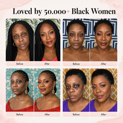 Finones™ Skincare- Loaded Adaptive Foundation SPF 15++