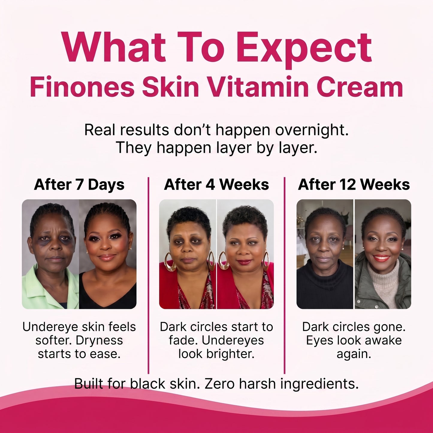 Finones Skin Vitamin Cream