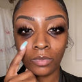 DARK SPOTS & DARK CIRCLES