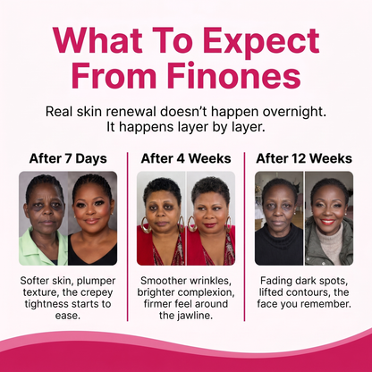 Finones™ Skin Vitamin Bundle