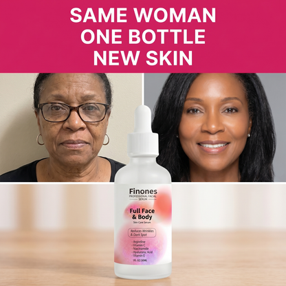 Finones™ Skin Vitamin Bundle