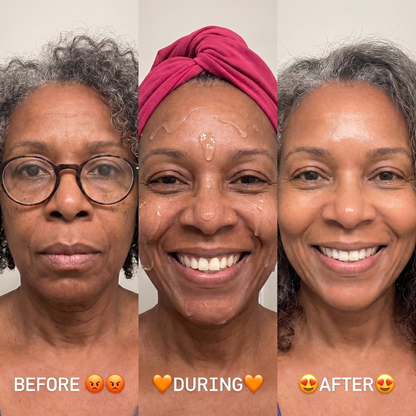 Finones™ Skin Vitamin Bundle