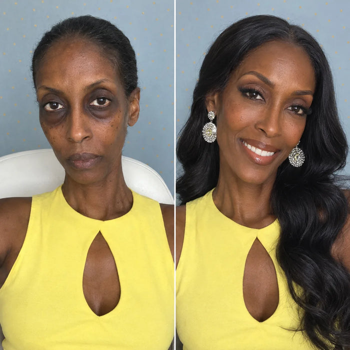 Discouraged woman with dark circles