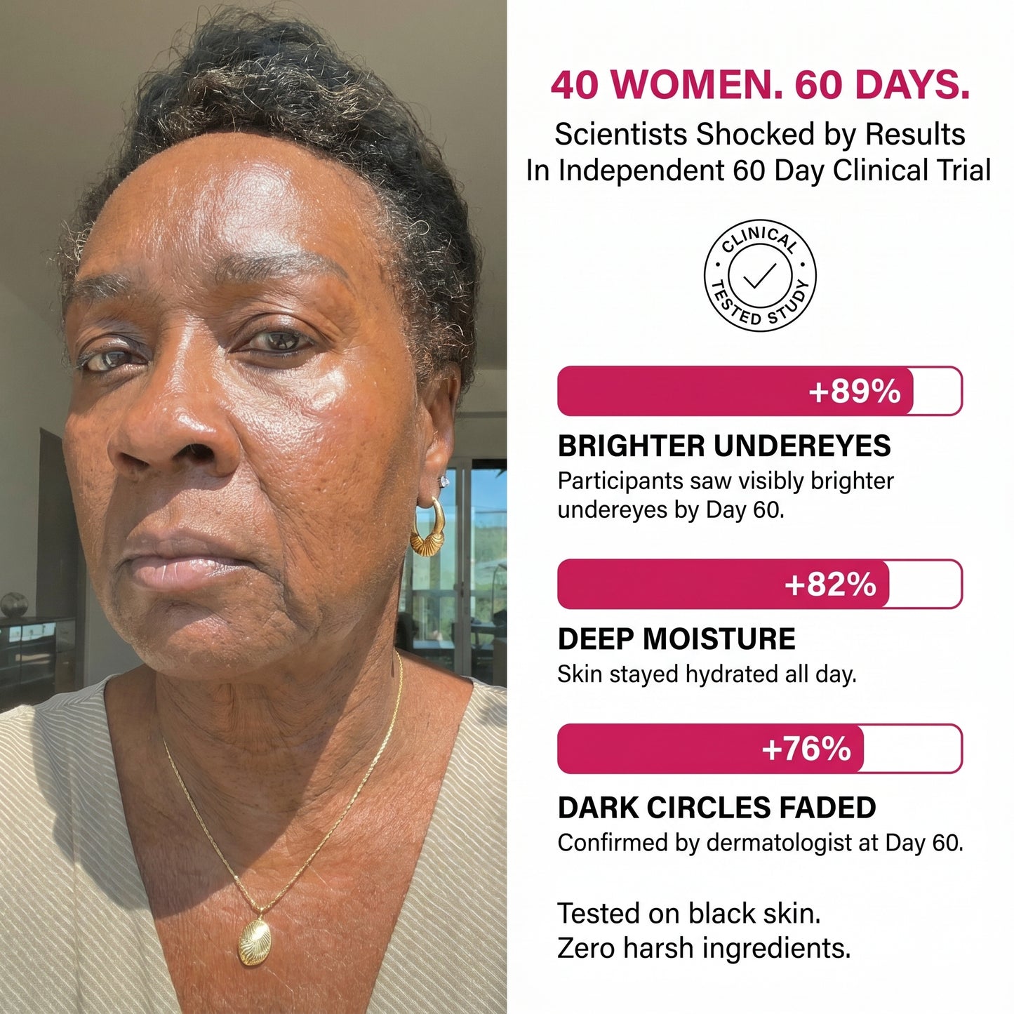 Finones Skin Vitamin Cream