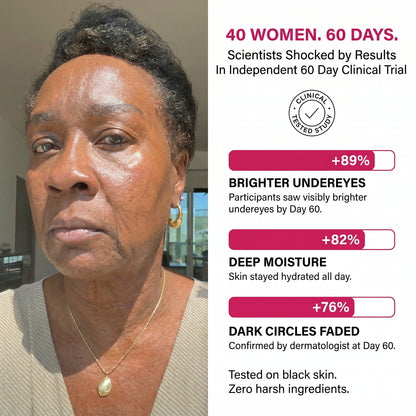 Finones Skin Vitamin Cream